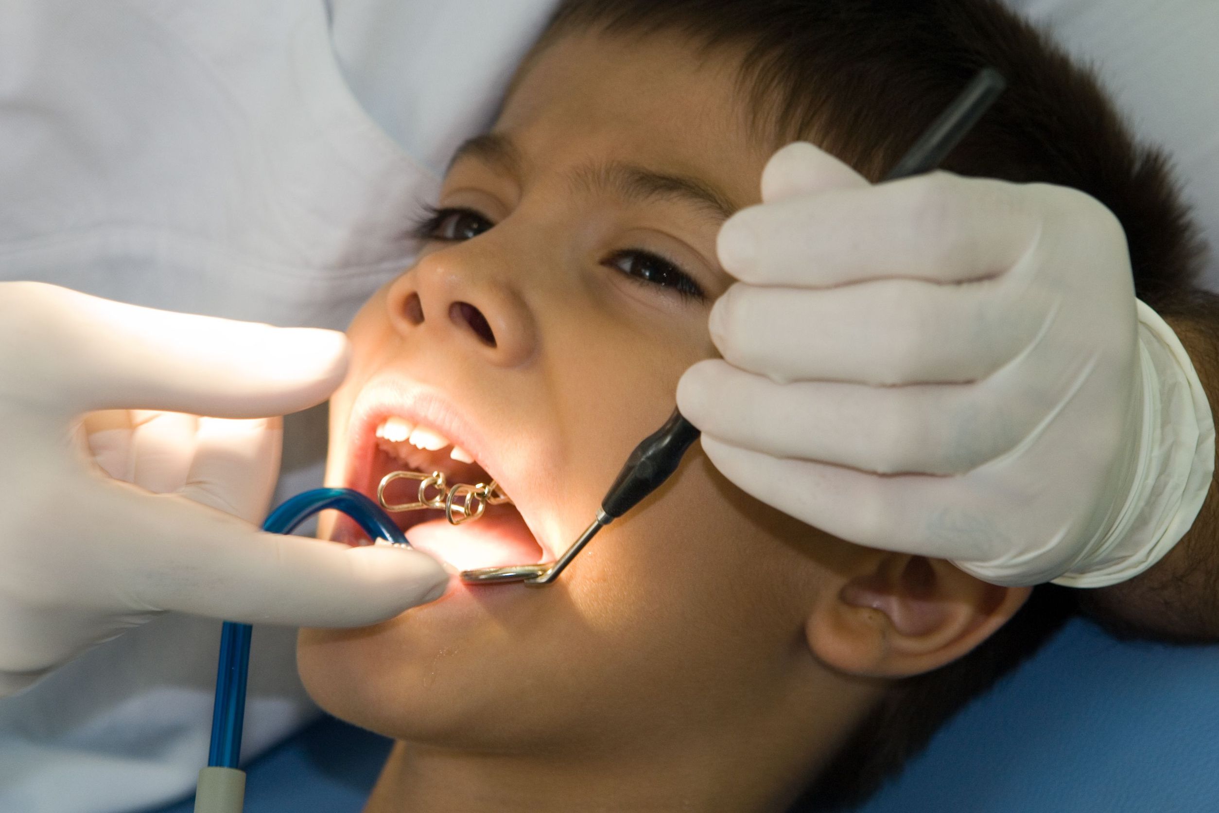 All About Teeth – Pediatric Dentist In Broken Arrow, OK