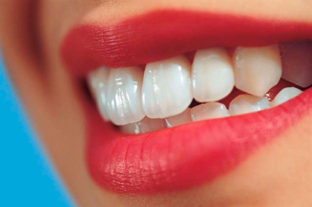 Aesthetic Teeth Solutions with Clear Braces