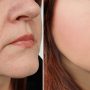 Treatment Options for Those Who Would Like Noninvasive Ways to Fight Aging