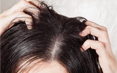 Looking for Real Results? This Game-Changing Hair Treatment in St Johns, FL, Is Getting Noticed